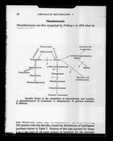view Copy of a printed diagram referenced as "Possible blocks in the metabolism of phenylalanine and tyrosine"