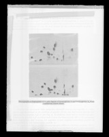 view Copy of a printed image captioned as "Photographs of fingerprints of tryptic of haemoglobin A and haemoglobin A2 from thalassemia minor blood" Referenced as "Part of myoglobin Fourier showing haem. (Kendrew)"