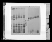 view Autoradiograph image referenced as "Starch gel electrophoresis autoradiography of transferrins (Smithies)"