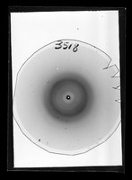 view X-ray diffraction exposure referenced as "X-ray film 3518 (Reversal)"