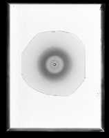 view X-ray diffraction exposure referenced as "Histone x-ray"