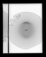 view X-ray diffraction exposure referenced as "4198"