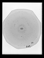 view X-ray diffraction exposure of nucleohistone referenced as "X-ray 525 B nucleohistone"