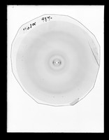 view X-ray diffraction exposure referenced as "X-ray 1431 a"