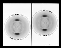 view X-ray diffraction exposure referenced as "X-ray dI/rC"