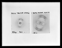 view X-ray diffraction exposures of RNA at 92% relative humidity referenced as 'X-ray photograph 269a'