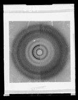 view Comparative x-ray diffraction exposure possibly of nuclehistone referenced as 'Dr Spencer'