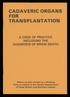 view Department of Health Working Party, Code of Practice: Cadveric Organs for Transplantation, including the diagnosis of brain death