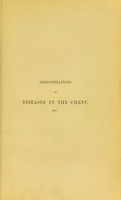 view Demonstrations of diseases in the chest : and their physical diagnosis / by Horace Dobell.