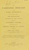 view On varicose disease of the lower extremities and its allied disorders : skin discoloration, induration, and ulcer being the Lettsomian Lectures delivered before the Medical Society of London in 1867 / by John Gay.