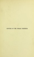 view On the treatment of rupture of the female perineum, immediate and remote / by George Granville Bantock.