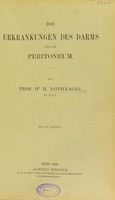 view Die Erkrankungen des Darms und des Peritoneum / von H. Nothnagel.