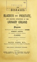 view On diseases of the bladder and prostate, and obscure affections of the urinary organs : with diagrams illustrating the author's treatment of stone without cutting, and numerous successfully treated cases hitherto regarded as "incurable" / by David Jones.