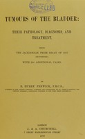 view Tumours of the bladder : their pathology, diagnosis, and treatment being the Jacksonian prize essay of 1887 (re-written), with 200 additional cases / by E. Hurry Fenwick.