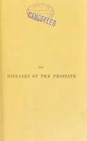 view The diseases of the prostate, their pathology and treatment : comprising the Jacksonian prize essay for the year 1860 / by Sir Henry Thompson.