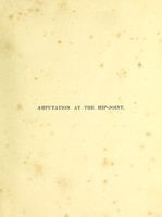 view History of a successful case of amputation at the hip-joint : (the limb 48 inches in circumference, 99 pounds weight) / by J. Sampson Gamgee.