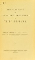 view On the pathology and operative treatment of "hip" disease / by Thomas Annandale.