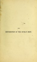 view The deformities of the human body : a system of orthopaedic surgery being a course of lectures delivered at St. George's Hospital / by Bernard E. Brodhurst.