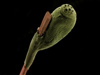 view Head louse egg attached to a strand of hair, SEM.