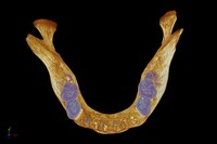 view Medieval human mandible (lower jaw bone).