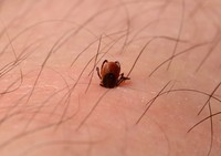 view Deer tick embedded in skin of leg.