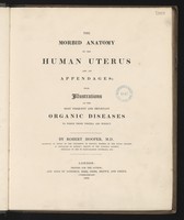 view The morbid anatomy of the human uterus and its appendages; with illustrations of the most frequent and important organic diseases. To which those viscera are subject / by Robert Hooper.