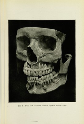 Oral anaesthesia; local anaesthesia in the oral cavity