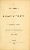 view Treatise on the diseases of the eye / by W. Lawrence.