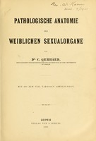 view Pathologische Anatomie der weiblichen Sexualorgane / von C. Gebhard.