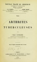 view Arthrites tuberculeuses.