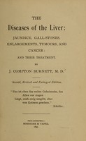 view The diseases of the liver : jaundice, gall-stones, enlargements, tumours, and cancer: and their treatment / By J. Compton Burnett, M. D.