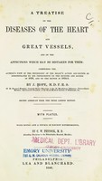 view A Treatise on the diseases of the heart and great vessels : and on the affections which may be mistaken for them, comprising the author's view of the physiology of the heart's action / by J. Hope.