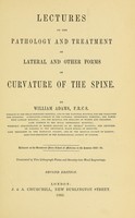 view Lectures on the pathology and treatment of lateral and other forms of curvature of the spine / by William Adams.