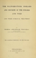 view The malformations, diseases and injuries of the fingers and toes : and their surgical treatment / by Thomas Annandale.