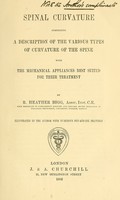 view Spinal curvature : comprising a description of the various types of curvature of the spine with the mechanical appliances best suited for their treatment / by R. Heather Bigg ; ill. by the author with numerous pen-and-ink drawings.