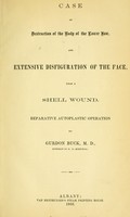 view Case of destruction of the body of the lower jaw, and extensive disfiguration of the face, from a shell wound : reparative autoplastic operation / by Gurdon Buck.