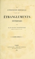 view De l'intervention chirurgicale dans les etranglements internes / par Eugéne Charpentier.