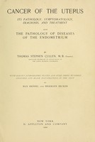 view Cancer of the uterus : its pathology, symptomatology, diagnosis, and treatment : also the pathology of diseases of the endometrium / by Thomas Stephen Cullen ; with eleven lithographic plates and over three hundred coloured and black illustrations in the text by May Brödel and Hermann Becker.