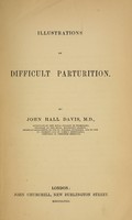 view Illustrations of difficult parturition.