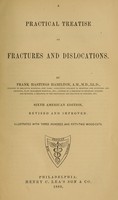 view A practical treatise on fractures and dislocations / by Frank Hastings Hamilton.
