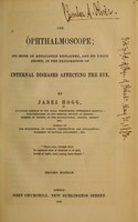view The ophthalmoscope : its mode of application explained, and its value shown, in the exploration of internal diseases affecting the eye / by Jabez Hogg.