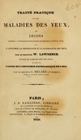 view Traité pratique sur les maladies des yeux, ou, Leçons données à l'infirmerie opthalmique de Londres en 1825 et 1826, sur l'anatomie, la physiologie et la pathologie des yeux / par W. Lawrence ; traduit de l'anglais avec des notes, et suivi d'un précis de l'anatomie pathologique de l'oeil, par C. Billard.