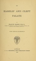 view On harelip and cleft palate / by Francis Mason.