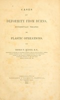 view Cases of deformity from burns, successfully treated by plastic operations / by Thomas D. Mütter.