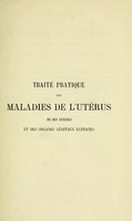 view Traité pratique des maladies de l'utérus : de ses annexes et des organes génitaux externes / par Aug. Nonat.