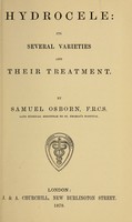 view Hydrocele : its several varieties and their treatment / by Samuel Osborn.