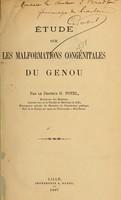 view Étude sur les malformations congénitales du genou / par G. Potel.