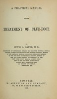 view A practical manual of the treatment of club-foot / by Lewis A. Sayre.
