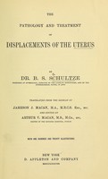 view The Pathology and treatment of displacements of the uterus / by B.S. Schultze ; tr. from the German by Jameson J. Macan ; and ed. by Arthur V. Macan ; with one hundred and twenty illustrations.