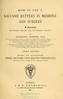 view How to use a galvanic battery in medicine and surgery : adiscourse delivered before the Hunterian Society / by Herbert Tibbits.